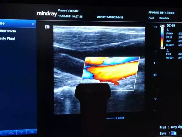 manos de una persona