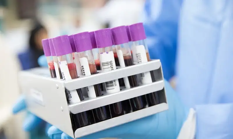 toma de muestra dímero D para diagnóstico trombosis